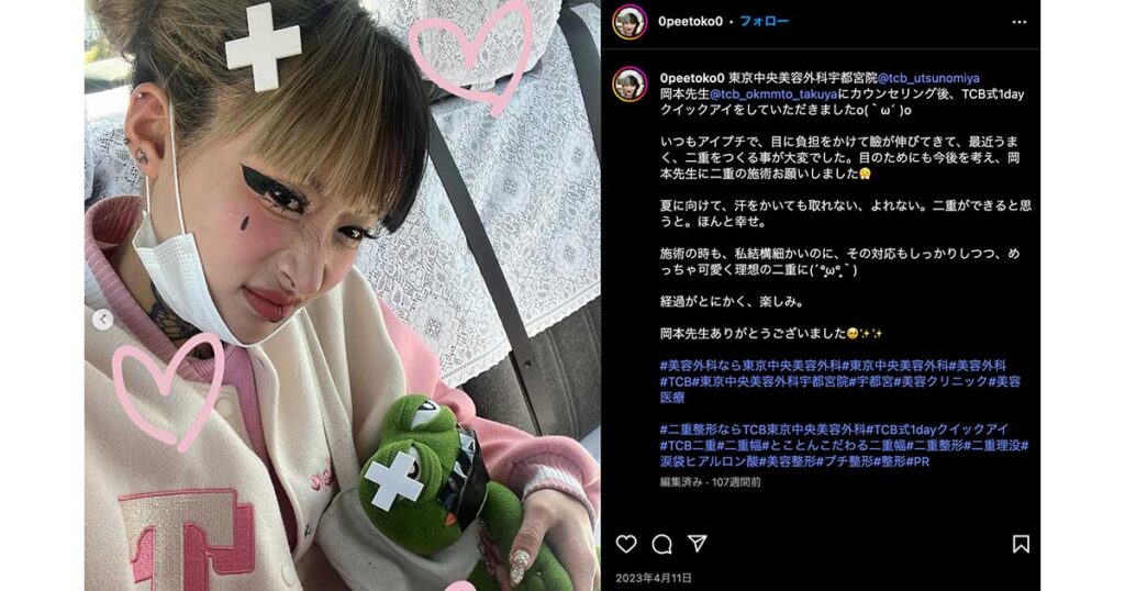 トチョニカペペ,整形,すっぴん