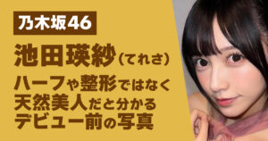 池田瑛紗、ハーフ、整形