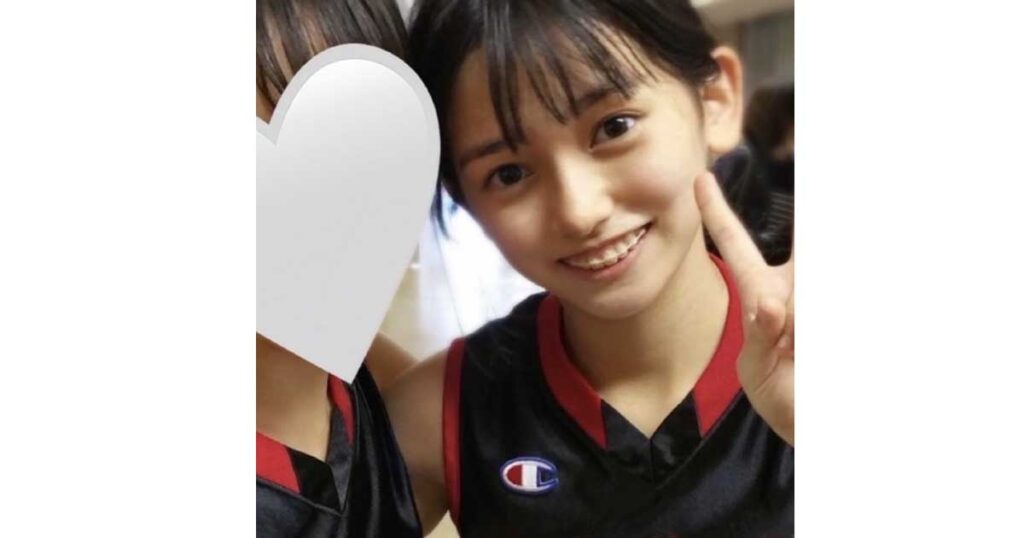 池田瑛紗、ハーフ、整形