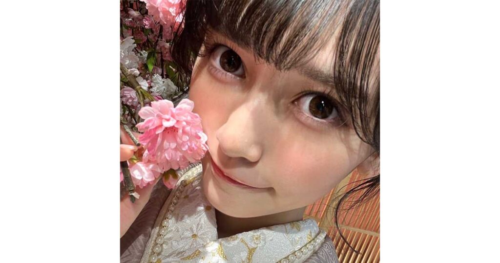 池田瑛紗、ハーフ、整形