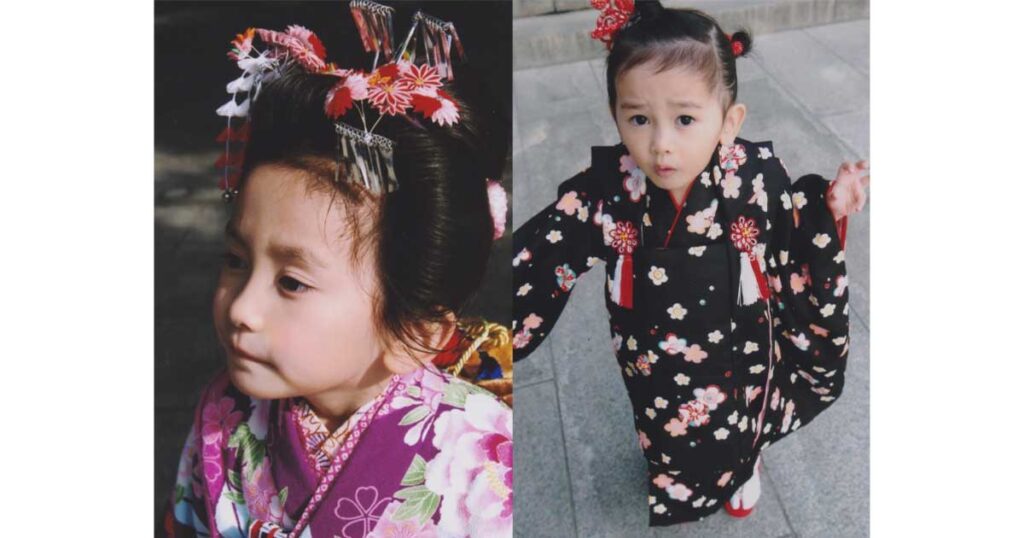 池田瑛紗、ハーフ、整形