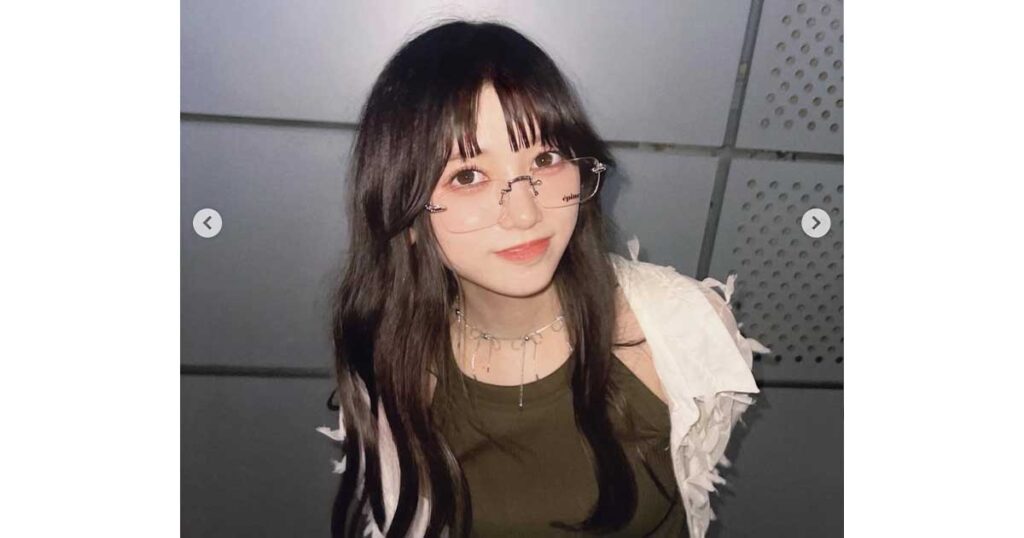 池田瑛紗、ハーフ、整形