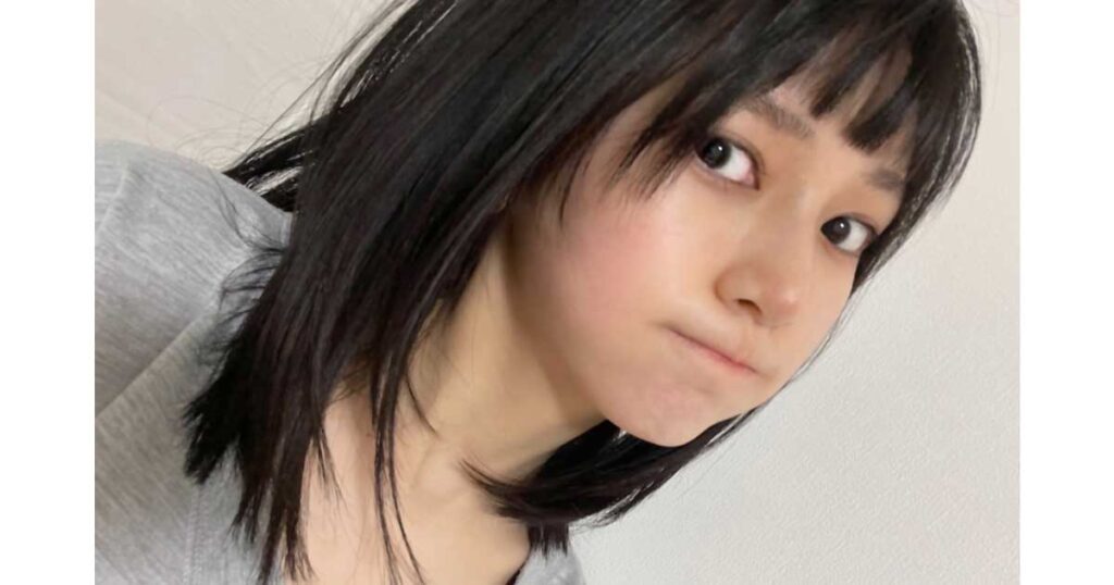 池田瑛紗、ハーフ、整形