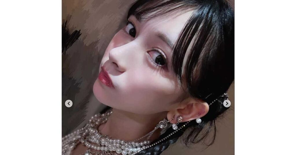 池田瑛紗、ハーフ、整形