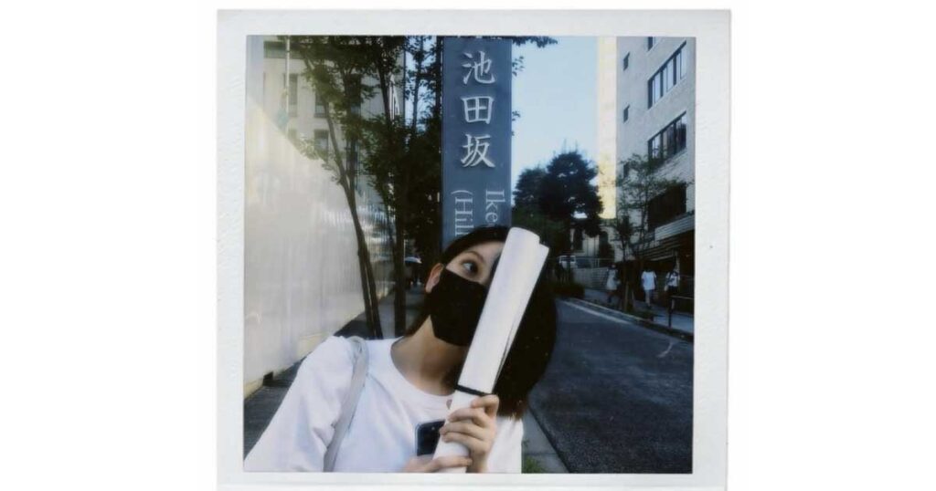 池田瑛紗、ハーフ、整形