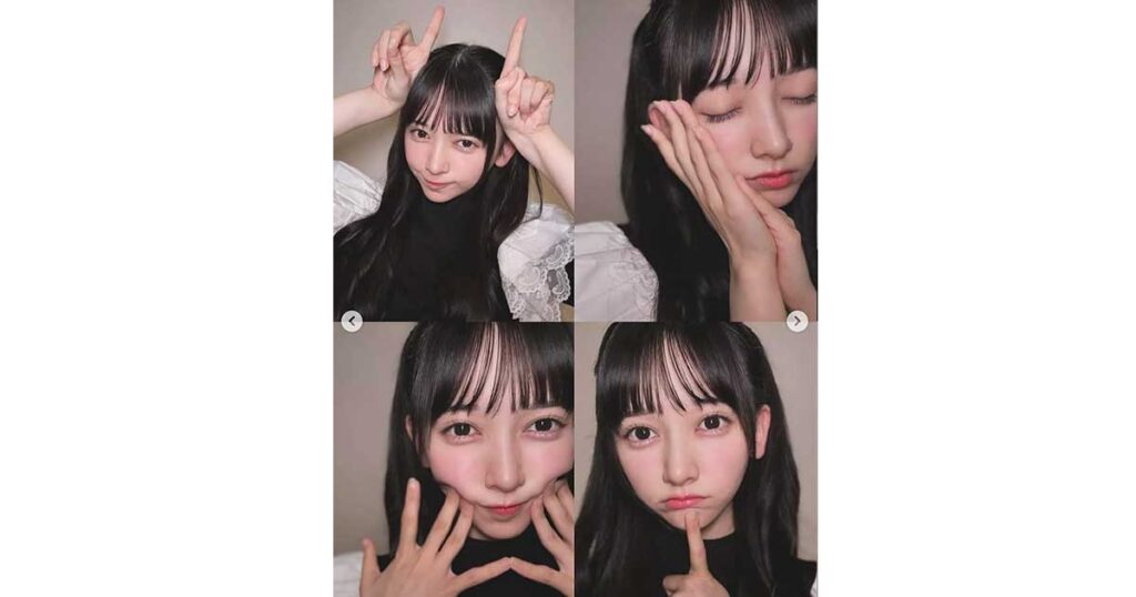 池田瑛紗、ハーフ、整形