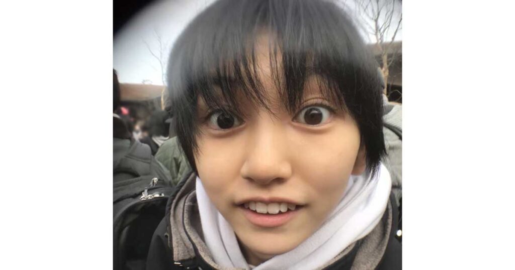 池田瑛紗、ハーフ、整形